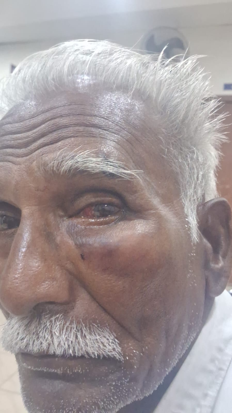 தூத்துக்குடியில் பரபரப்பு  சட்டவிரோத மது விற்பனை குறித்து புகார்: காங்கிரஸ் மாநகர் மாவட்டத் தலைவர் தந்தை மீது வீடு புகுந்து தாக்குதல்  வாலிபரை போலீசார் வலைவீசி தேடல் – காங்கிரஸ் கட்சியினர் கண்டனம்